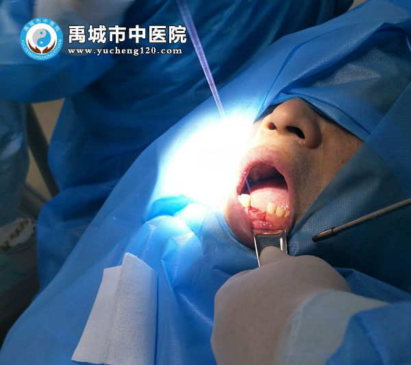 禹城市中医院口腔科成功进行了种植牙手术